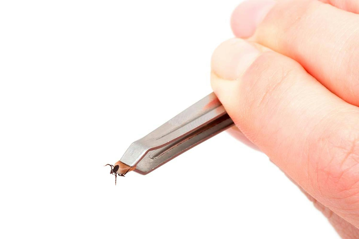 Ta bort fästing Hur tar man bort en fästing?